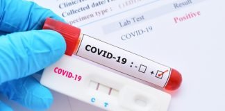 Pruebas Covid