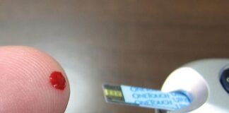 Hidalgo registró 516 casos de diabetes Mellitus Tipo 2 en T3-2021 diabetes Mellitus