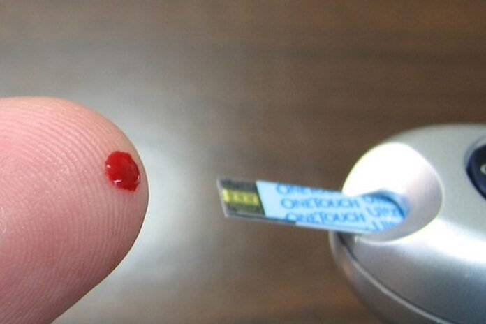 diabetes Mellitus diabetes Mellitus