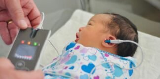 Aplicación de tamiz neonatal auditivo en clínicas del ISSSTE