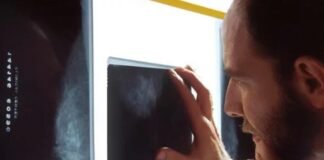 Detectar a tiempo el cáncer de colon puede marcar la diferencia en adultos jóvenes