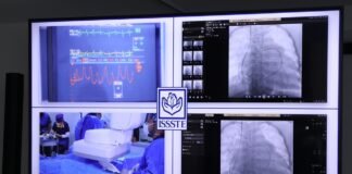 Especialistas del ISSSTE se capacitan en diagnósticos de hipertensión pulmonar