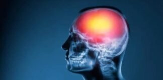 Conmociones cerebrales: ¿Por qué la microbiota intestinal es clave para tratarlas?