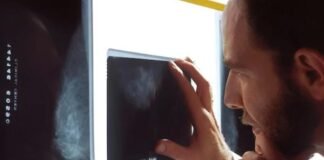 Detección tardía de la esclerosis múltiple afecta a los pacientes