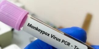 Participan 7 países latinos en entrenamiento sobre detección y diagnóstico de viruela símica