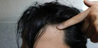 Científicos descubren relación entre el sistema inmunológico y el crecimiento capilar