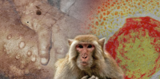 Reportan primera muerte por viruela del mono en Brasil