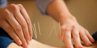 La terapia de acupuntura puede ser una herramienta útil para prevenir la diabetes