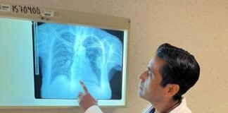 Tabaquismo, el primer enemigo de la salud pulmonar: ISSSTE
