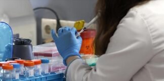 Confirma Hidalgo el primer caso de viruela del mono