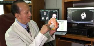 Implanta ISSSTE chip cerebral en pacientes con Parkinson
