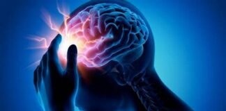 Epilepsia, enfermedad estigmatizada que la padecen más de 50 millones de personas