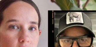 Mánager de Ximena Sariñana perderá ojo derecho tras ataque en Feria de Texcoco