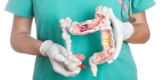 Diez recomendaciones para reducir el riesgo de cáncer colorrectal