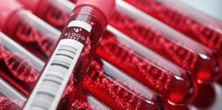 Hemofilia: panorama y cómo vivir con esta enfermedad en México