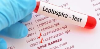 Salud exhorta a cuidar higiene de agua y alimentos para evitar la leptospirosis