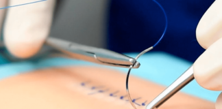 Científicos del MIT crean nuevas suturas que derivan de tejido animal