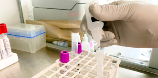 ONU critica a países desarrollados por no ceder patente de vacunas contra Covid-19