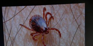 Congreso de Sonora busca declarar emergencia sanitaria por rickettsia