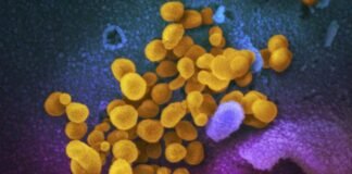 OMS y EU vigilan a la variante BA.2.86 de Covid-19; aun desconocen su potencial de impacto