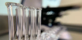 Biomarcador sanguíneo para predecir Alzheimer podría revolucionar su diagnóstico