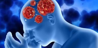 Tecnología revolucionaria: Implante cerebral personalizado alivia TOC y epilepsia