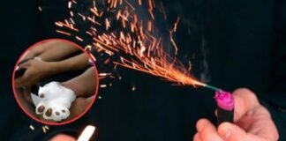 Niño pierde dedos de ambas manos por explosión de pirotecnia