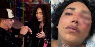 Paola Suárez de ‘Las Perdidas’ podría perder el ojo tras golpiza de su prometido