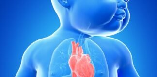 Cardiopatías, primer lugar de muerte en infantes hidalguenses: SSH