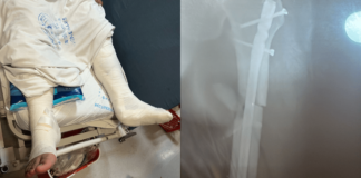 A siete meses de ser atropellado su caso permanece estancado en PGJH