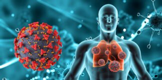 Avanza “Frankenstein” sub-variante XFG del COVID-19