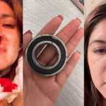 Pasajera sufre fractura de naríz durante riña de choferes de combi