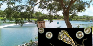 Alerta por ameba “comecerebros” en lagos artificiales de Mérida
