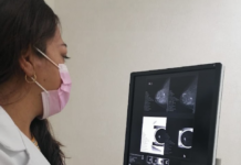 Hidalgo registra 186 casos de cáncer de mama en lo que va de 2026